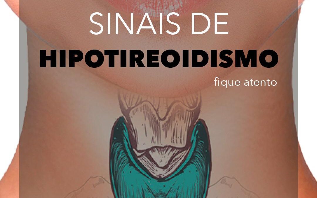 SINAIS DE HIPOTIREOIDISMO